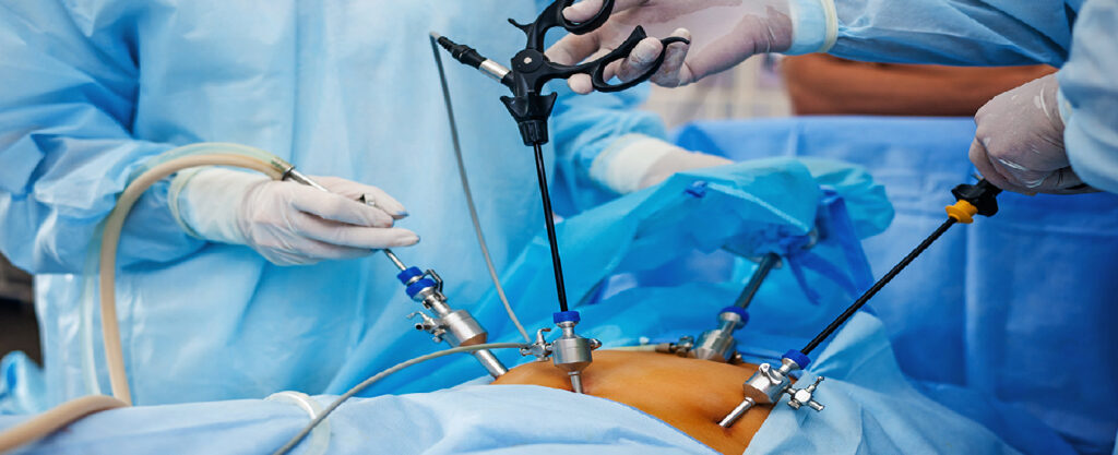 Laparoscopic Surgeries – Mithra Hospital